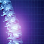 What Are the Common Types of Car Accident Back Injuries?