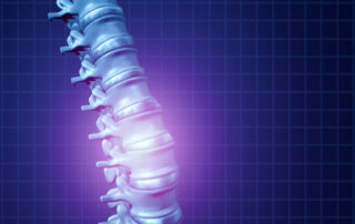 Need Help After a Crash-Related Back Injury? Contact Our South Bend Car Accident Lawyers at Wilson & Kinsman, LLC
