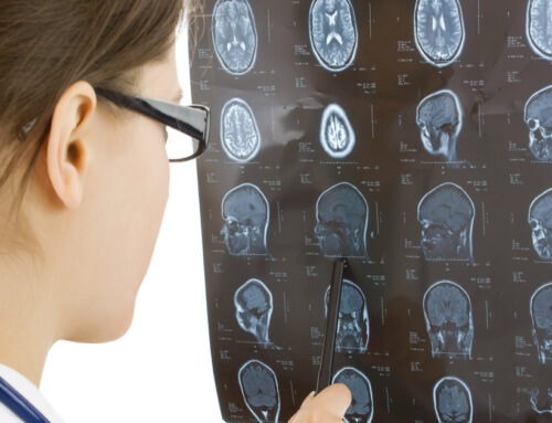 What Is the Link Between Car Accidents and Traumatic Brain Injuries (TBIs)?