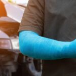 Can I Collect Compensation for Permanent Scarring From a Car Accident?